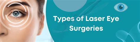 4 Types Of Laser Eye Surgery