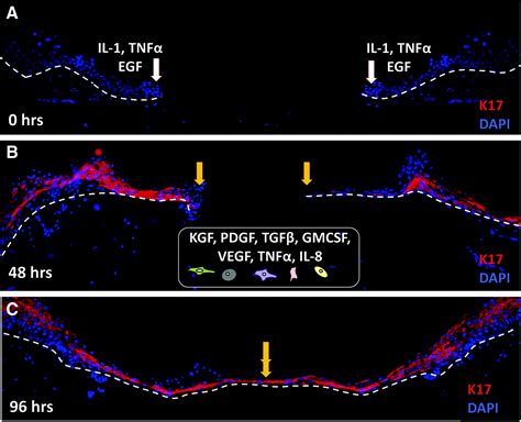 Epithelialization in Wound Healing: A Comprehensive Review | Advances ...