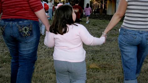 Severe childhood obesity on the rise in U.S., study shows - CBS News