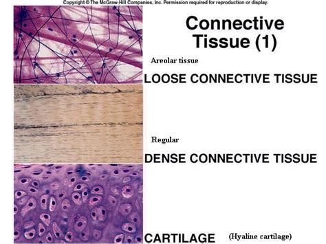 36 best images about Connective Tissue on Pinterest | Heart disease, Mast cell and Plays