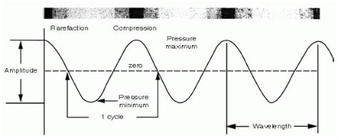 Physics of Echocardiography | Thoracic Key