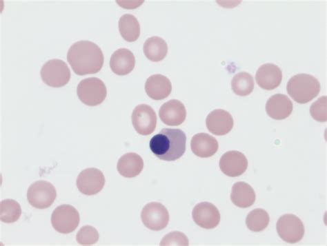 Nucleated Red Blood Cells