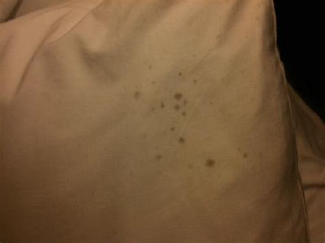 Pillowcase w/mildew stains - Picture of Wyndham Lake Buena Vista, Orlando - TripAdvisor