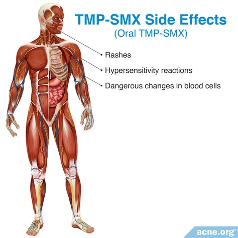 The Side Effects of Antibiotics - Acne.org