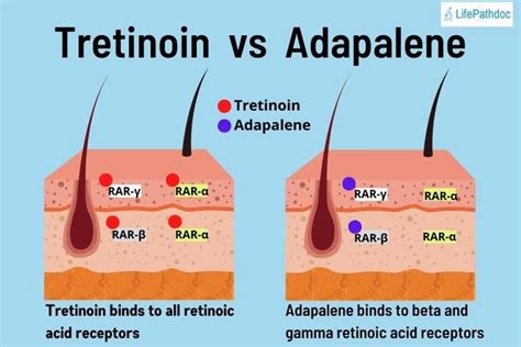 Adapalene (Differin) vs. Tretinoin for Wrinkles, Acne, and Scars