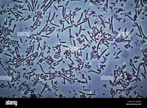 Bacteria taken from Human Mouth, LM Stock Photo - Alamy