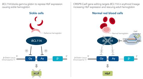 Precise Gene Editing's Impact on Sickle Cell Disease | IDT