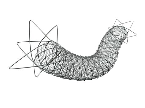 Roadsaver™ Carotid Artery Stent