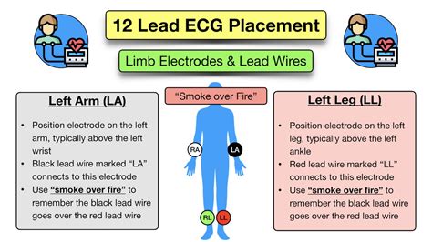 12 Lead ECG Placement: Diagram and Mnemonic for Limb and Precordial Electrode Location — EZmed