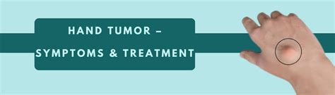 Hand Tumor – Symptoms & Treatment