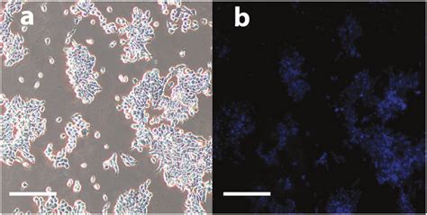 Fluorescence labelling of HT 29 cell line. (a) Phase contrast and (b ...