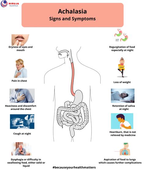 Achalalasia: Signs & Symptoms