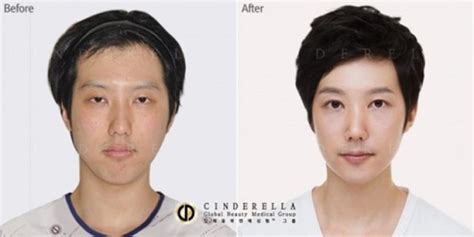 81 photos of plastic surgery in Korea that will make your jaw drop - Stomp