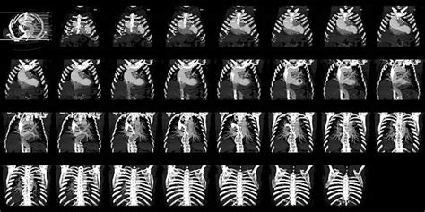 2,000+ Anatomy Spleen Pictures Stock Photos, Pictures & Royalty-Free ...