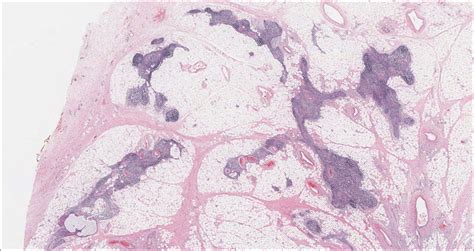 Thymus – Normal Histology – NUS Pathweb :: NUS Pathweb