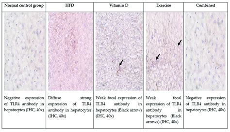 TLR expression by immunohistochemistry in the five studied groups in... | Download Scientific ...