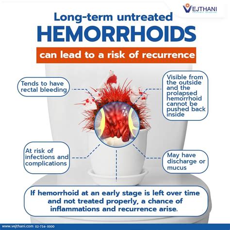 External Hemorrhoid Stages