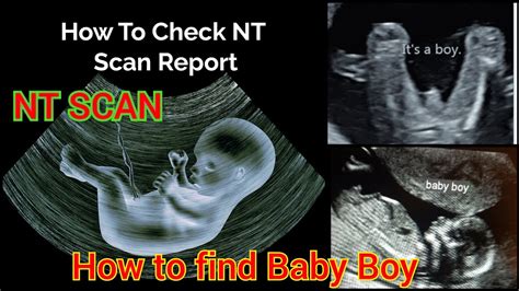 NT SCAN || How to Find Baby's Gender In NT SCAN || NT scan report #pregnancy #ntscanreport # ...