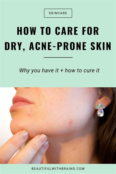 How to deal with acne and dry skin