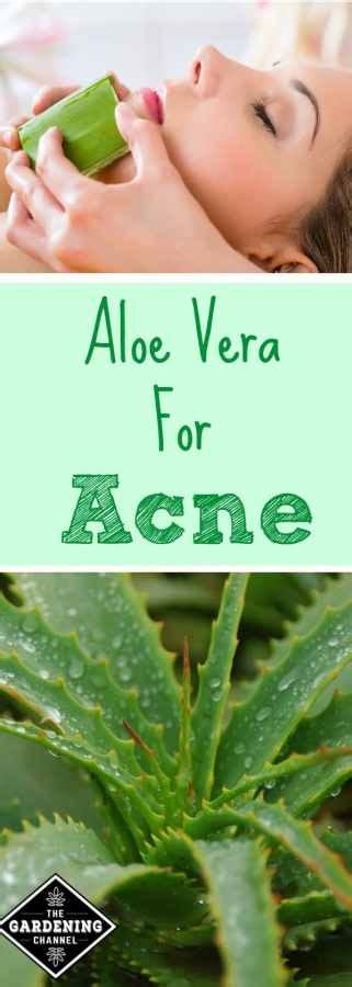 Aloe Vera for Acne - Gardening Channel