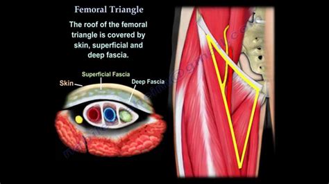 Femoral Ring Boundaries