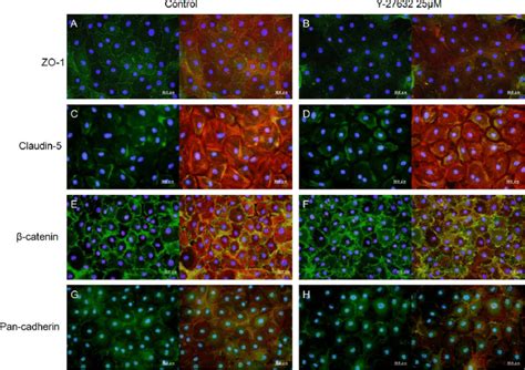 Effects of the ROCK inhibitor Y-27632 on cell-cell contact and actin ...