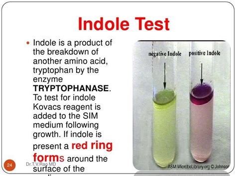 Indole Test | Medical laboratory scientist, Medical laboratory science, Teaching biology