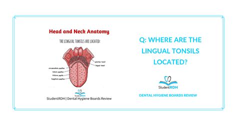 Q: Where are the lingual tonsils located? - StudentRDH Blog