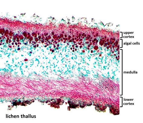 Foliose Lichen Under Microscope