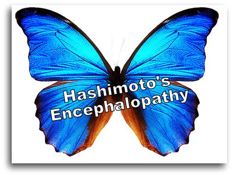 If you have Hashimoto's, you may want to become aware of Hashimoto's Encephalopathy - Stop The ...