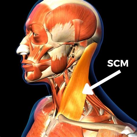 All About the Sternocleidomastoid Muscle: Anatomy and Treatment