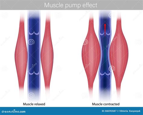 Skeletal Muscle Pump Effect. Illustration of Muscle Pump Effect on ...