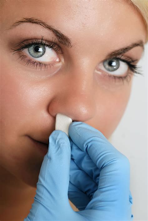 New HemCon®/Seal-On™ Nasal Plugs Control Nosebleeds Quickly ...