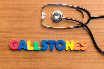 Gallstones Alert: Symptoms and Factors Leading to Formation - Freedom From PCOS