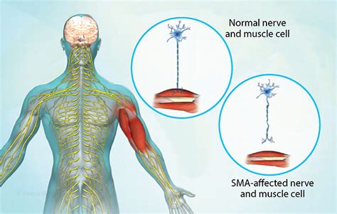 Health Condition : Symptoms, Causes, Treatment and More