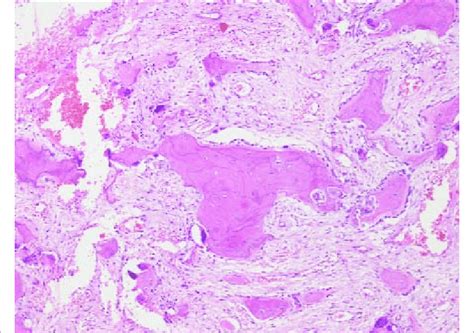 Photomicrograph showing trabeculae of lamellar bone with mosaic pattern... | Download Scientific ...