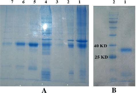 Showing the SDS-PAGE gel electrophoresis representing the purified... | Download Scientific Diagram