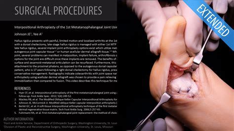 What Is A Johnson Joint at Gregory Kopf blog