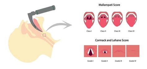 Comark: Over 1 Royalty-Free Licensable Stock Vectors & Vector Art | Shutterstock