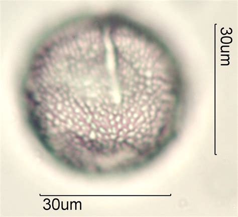 Western Jimson-weed (Datura wrightii) Pollen Through the Microscope