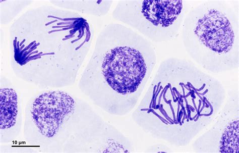 Observing Mitosis - Snab Biology