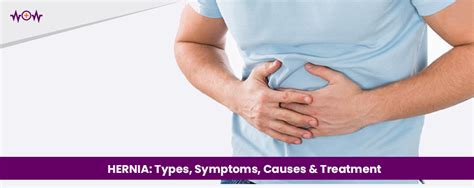 HERNIA: Types, Symptoms, Causes & Treatment - WoW Health Pakistan