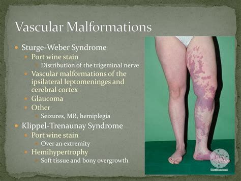 PPT - Hemangiomas and Vascular Malformations PowerPoint Presentation, free download - ID:780098