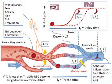 JCM | Free Full-Text | Vaso-Occlusion in Sickle Cell Disease: Is ...