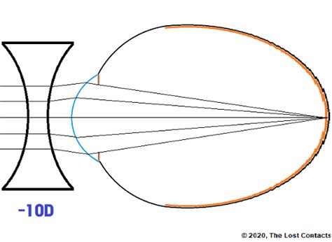 The Optics of Vision - Lesson 6: Emmetropia & Myopia - The Lost Contacts