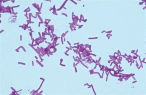 Figure 5. Gram stain of Salmonella typhimurium - Harnessing the Power ...