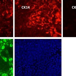 Differentiation of keratinocytes results in a mixture of immature and... | Download Scientific ...