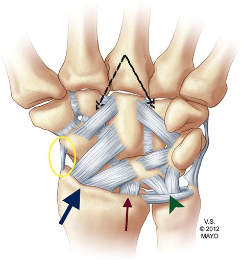 Volar Carpal Ligaments Wrist Anatomy Joints Anatomy Gross Anatomy | My XXX Hot Girl