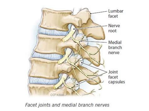 Facet Joint Injections for the Treatment of Pain - FV Hospital