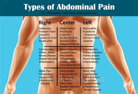 Types of Abdominal Pain or Stomach Ache Based on Organ Systems